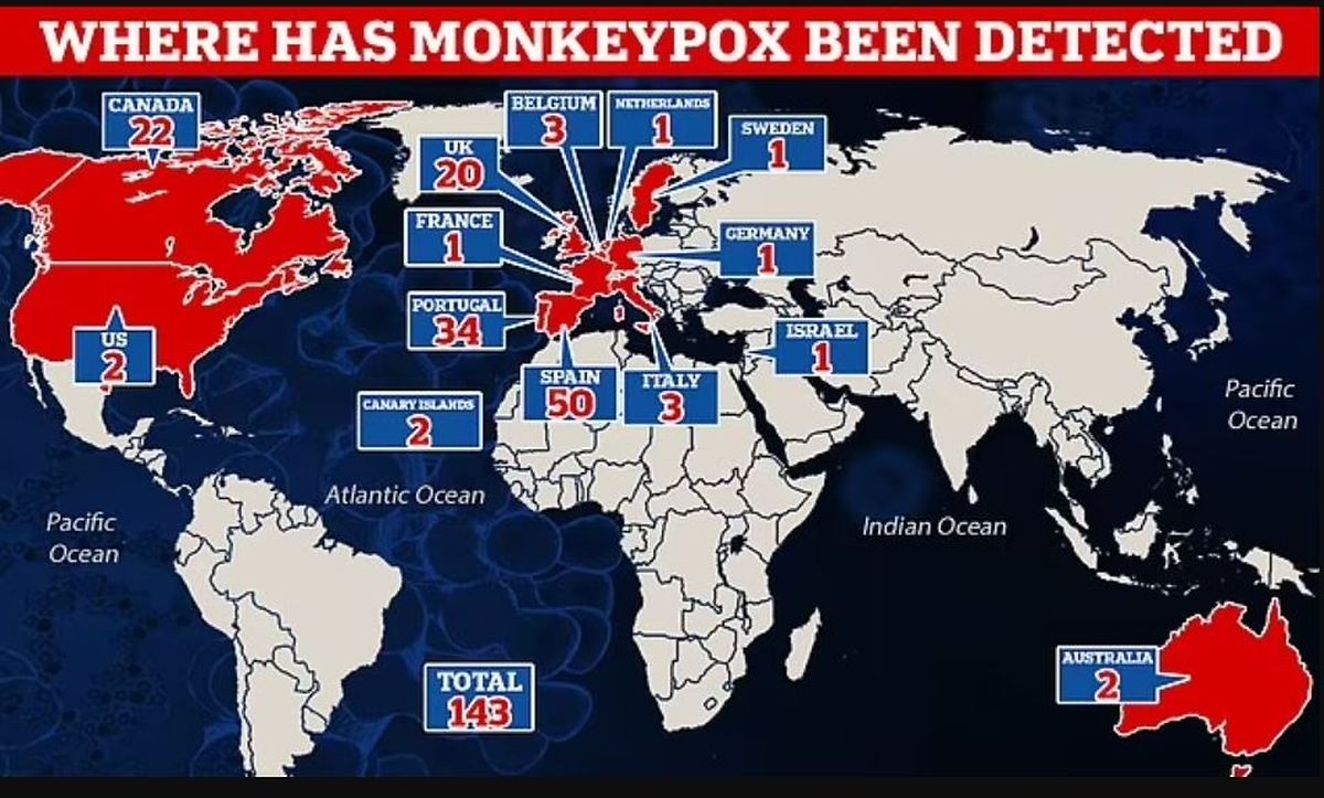 Cette carte du Daily Mail est devenue virale sur les réseaux sociaux. A noter qu'un quatrième cas de variole du singe a été détecté samedi en Belgique.