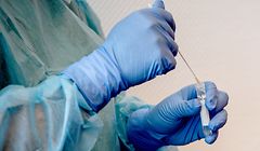 Die Infektionszahlen sind auf eine Woche geschaut leicht rückläufig, bewegen sich aber immer noch auf einem hohen Niveau. Am Mittwoch meldete die Santé 672 Neuinfektionen und vier Tote. 