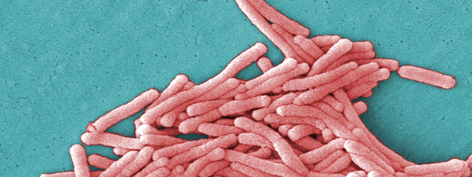 Em novembro de 2014 o concelho de Vila Franca de Xira foi também afetado por um surto de 'legionella'