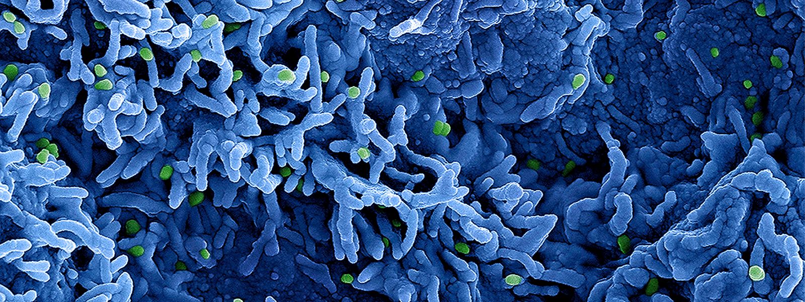 Eine kolorierte rasterelektronenmikroskopische Aufnahme des nun in Mpox umbenannten Affenpockenvirus.