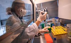 (FILES) In this file photo taken on January 25, 2021 a biochemist prepares samples as she works on a XAV-19 anti covid treatment as part of a clinical trial run at the Xenothera Biotech laboratory at Nantes University hospital, western France. - The Nantes-based biotech company Xenothera, created in 2014, is conducting a clinical trial in around twenty hospitals to test the therapeutic effectiveness of a Covid-19 treatment based on polyclonal antibodies, which is intended for patients at the beginning of their hospitalisation, the company announced on February 24, 2021. (Photo by LOIC VENANCE / AFP)