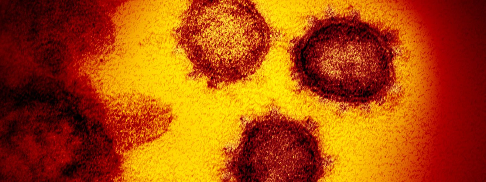 Die vom National Institute of Allergy and Infectious Diseases zur Verfügung gestellte Elektronenmikroskopaufnahme zeigt das Coronavirus SARS-CoV-2, das von einem Patienten in den USA isoliert wurde und aus der Oberfläche von im Labor kultivierten Zellen austritt.