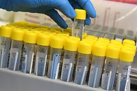 ARCHIV - 03.02.2022, Sachsen-Anhalt, Dessau-Roßlau: Im PCR-Labor bereitet eine medizinisch technische Laborassistentin die Bearbeitung von PCR-Tests in einem Automaten vor, die innerhalb von drei Stunden in dem Automaten analysiert werden. Die Zahl der PCR-Tests auf Sars-CoV-2 und ihre Positivrate sind nach Angaben eines Laborverbands in den vergangenen Wochen deutlich zurückgegangen. (zu dpa «Labore: Test- und Infektionsgeschehen weiter rückläufig») Foto: Waltraud Grubitzsch/dpa-Zentralbild/dpa +++ dpa-Bildfunk +++