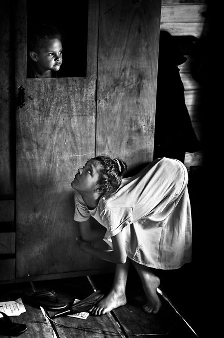 Jessica Scheffers Körper ist wegen genetischer Mutationen komplett deformiert.