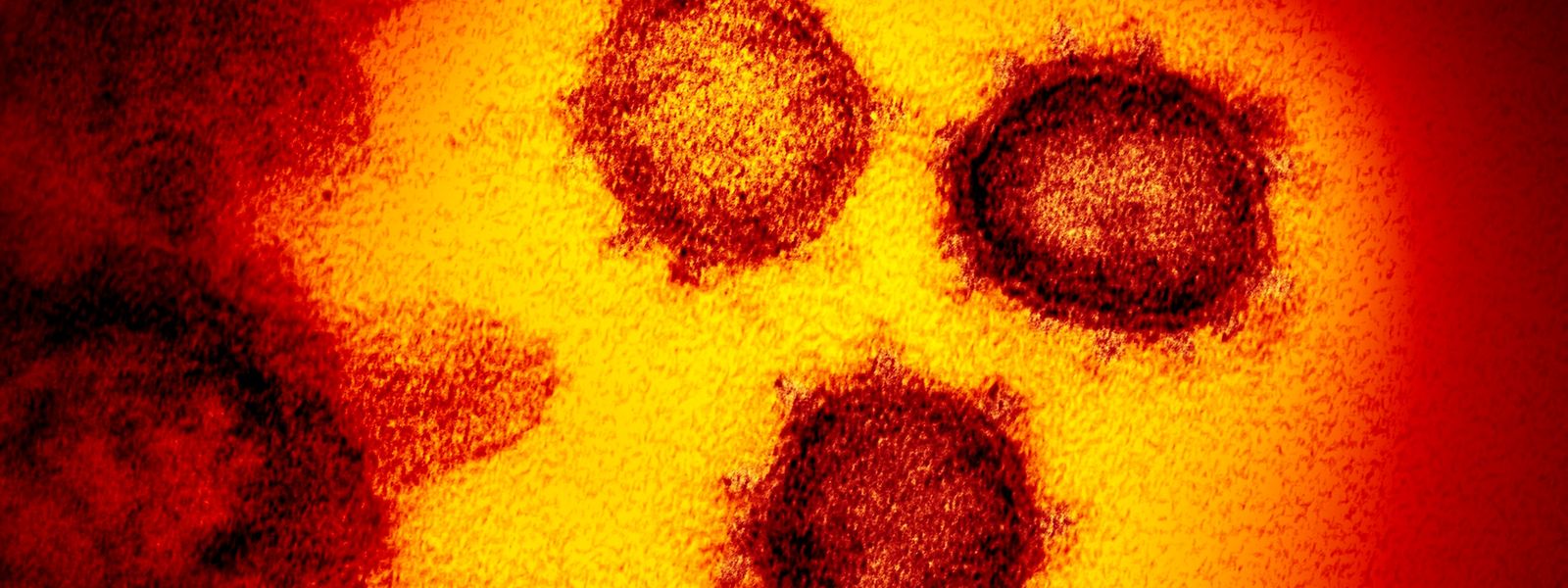 Der WHO-Bericht zum Ursprung des Corona-Virus liefert keinen eindeutigen Befund.