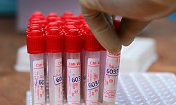A medical worker wearing Personal Protective Equipment (PPE) gear collects swab samples to test for the Covid-19 coronavirus, in Colombo on December 28, 2020. (Photo by ISHARA S. KODIKARA / AFP)