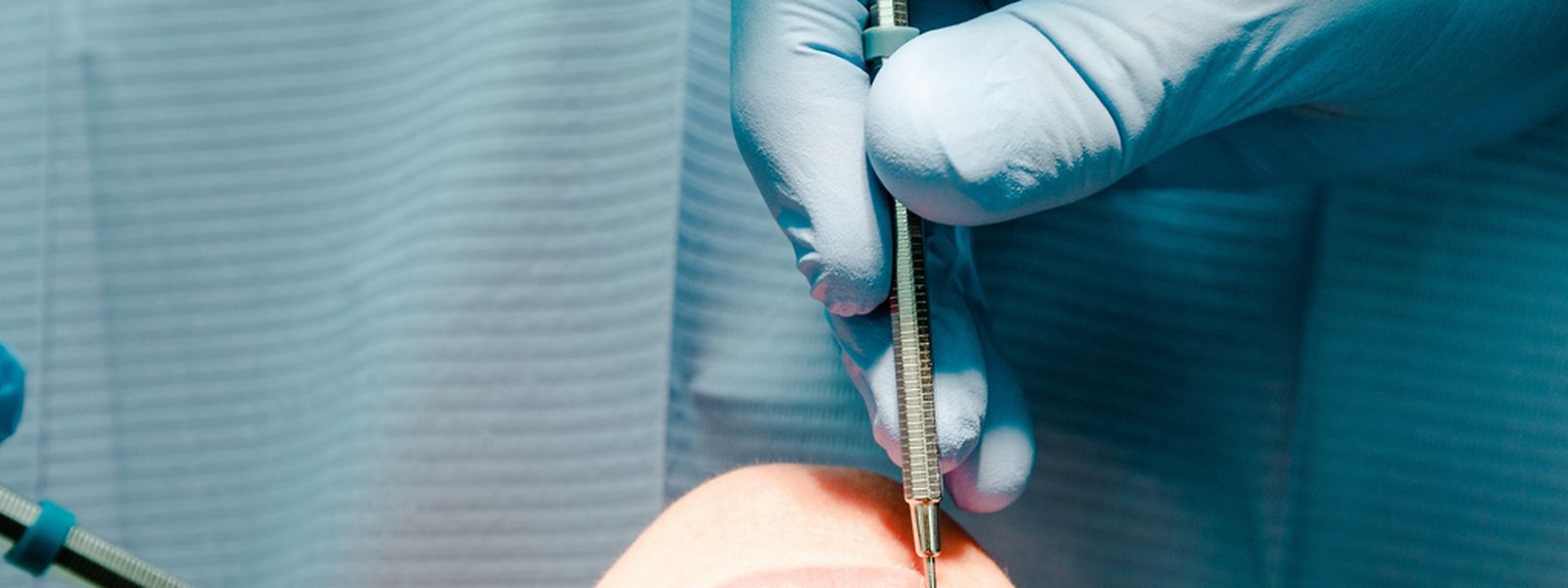 Wann Mussen Weisheitszahne Raus Weisheitszahn Op Gut Abwagen