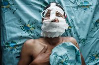 TOPSHOT - An injured Tigray Defence Forces (TDF) soldier who was shot his cheek lays in bed after surgery at the Ayder Referral Hospital in Mekele, the capital of Tigray region, Ethiopia, on July 2, 2021. (Photo by Yasuyoshi Chiba / AFP)