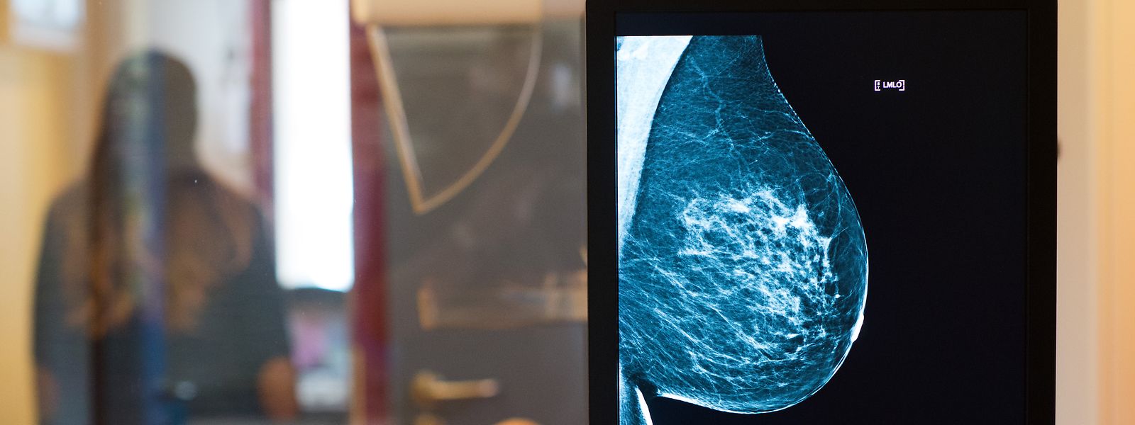 A mamografia é um dos exames cujo tempo de espera é consideravelmente longo