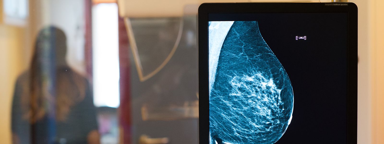 Mammografien wurden während der Pandemie drastisch eingeschränkt, erste Zahlen zu den Spätfolgen werden demnächst veröffentlicht. 