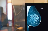 A mamografia é um dos exames cujo tempo de espera é consideravelmente longo