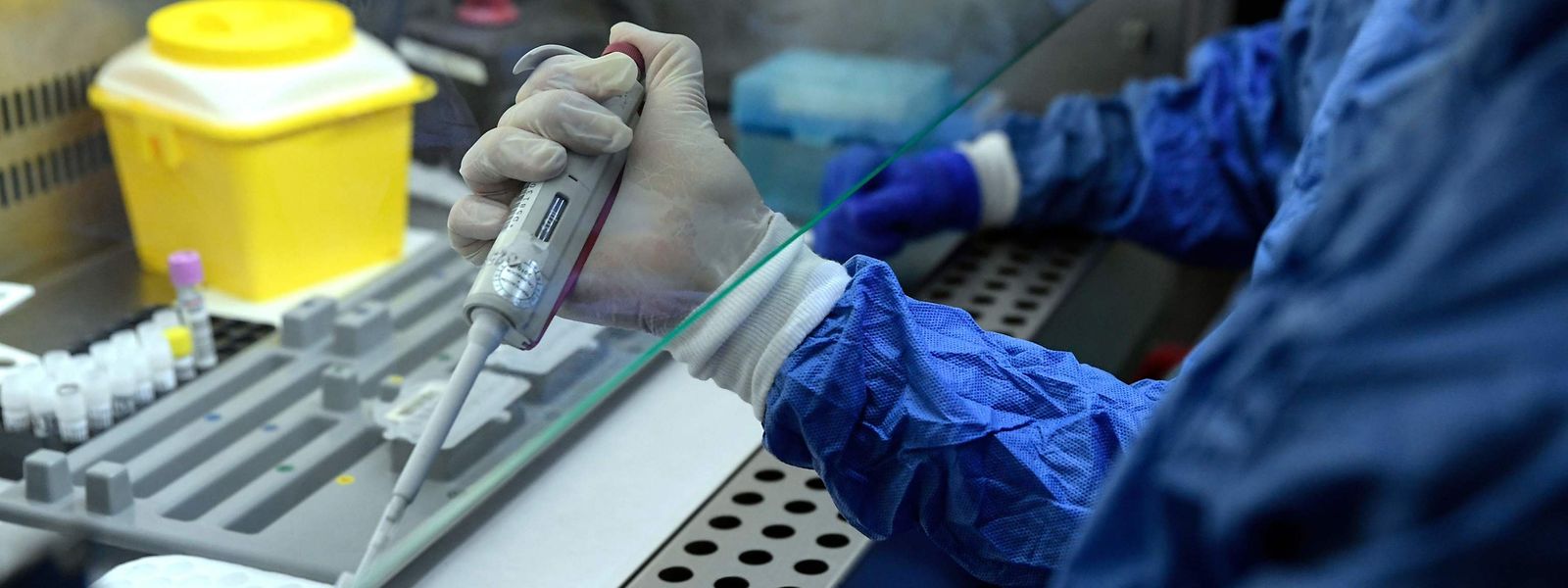 Die sogenannten PCR-Tests (Polymerase chain reaction) sind im späteren Krankheitsverlauf mit gewissen Unsicherheiten behaftet.