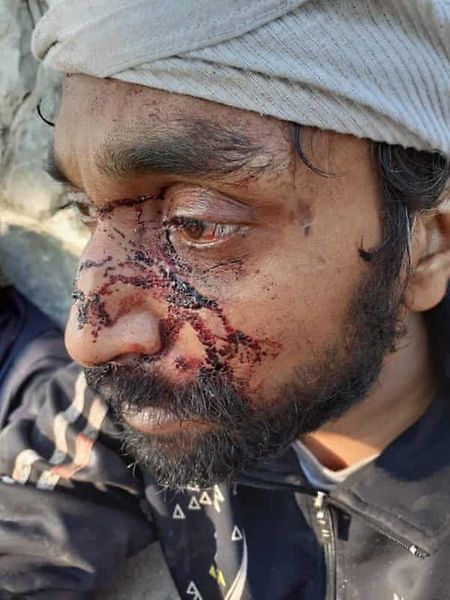 Um dos migrantes atacados por homens fardados.