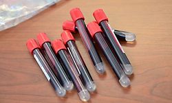 Blood samples are collected on residents to detect the COVID-19 (novel coronavirus) in the sports hall of the small town of Robbio, northern Italy, on April 4, 2020, as part of an initiative of the mayor, as Italy's three-week lockdown to stop the spread of COVID-19 has been extended through at least mid-April. (Photo by Miguel MEDINA / AFP)