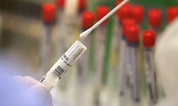 Ein Wattestäbchen eines Corona Abstriches wird im Labor bearbeitet.