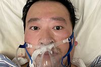 A photo obtained on February 7, 2020 shows Chinese coronavirus whistleblowing doctor Li Wenliang whose death was confirmed on February 7, lying on a bed at the Wuhan Central Hospital, China. - The death of a whistleblowing ophthalmologist whose early warnings about China's new coronavirus outbreak were suppressed by the police has unleashed a wave of anger at the government's handling of the crisis -- and bold demands for more freedom. (Photo by Li WENLIANG / Social Media / AFP) / RESTRICTED TO EDITORIAL USE - MANDATORY CREDIT "AFP PHOTO /Li WENLIANG" - NO MARKETING - NO ADVERTISING CAMPAIGNS - DISTRIBUTED AS A SERVICE TO CLIENTS