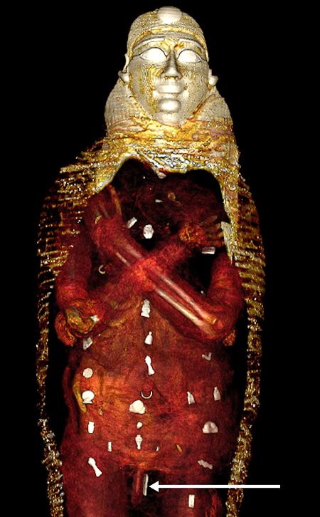 Das digitale Abbild zeigt die Amulette (weiß), die in drei Spalten im Inneren der Mumie platziert wurden.