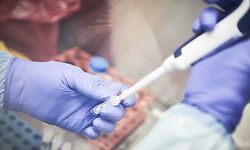 A Malian researcher conducts a COVID-19 coronavirus test, in the laboratory of the "Point G" hospital in Bamako, on March 19, 2020. - Although no positive cases have yet been confirmed in Mali, hospitals and doctors are getting ready for a potential emergency. (Photo by MICHELE CATTANI / AFP)
