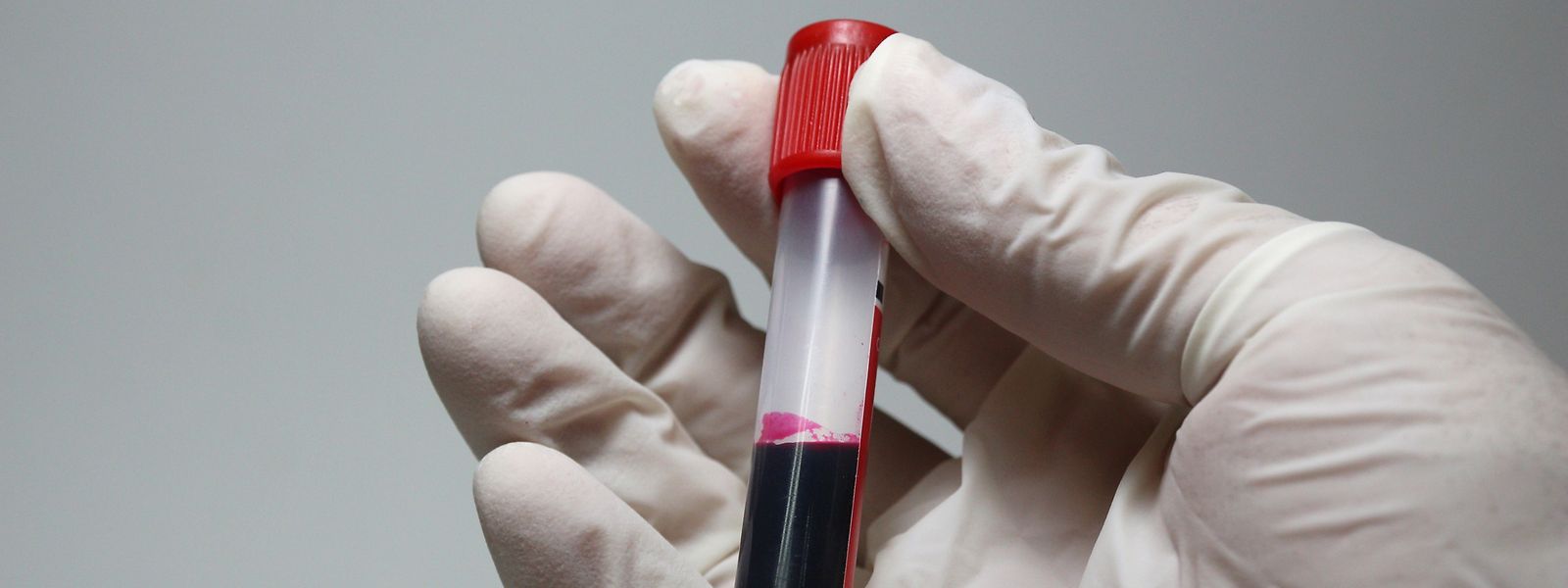 Die neue Nomenklatur sorgt für Unruhe bei den Laboren, den Ärzten und den Patienten. 