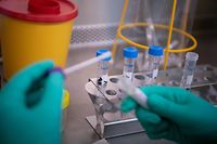 TOPSHOT - A laborant at the State Health Authorities of Baden-Wuerttemberg works on a test sample of a  suspected case of the 2019 Novel Coronavirus (2019-nCoV) in Stuttgart, sothern Germany on January 29, 2020. - Germany's first confirmed coronavirus patient caught the disease from a Chinese colleague who visited Germany last week, officials said on January 28, 2020, in the first human-to-human transmission on European soil, according to an AFP tally. (Photo by Marijan Murat / dpa / AFP) / Germany OUT