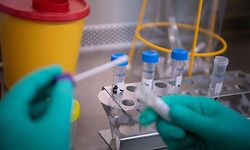 29 Tests fielen positiv aus.