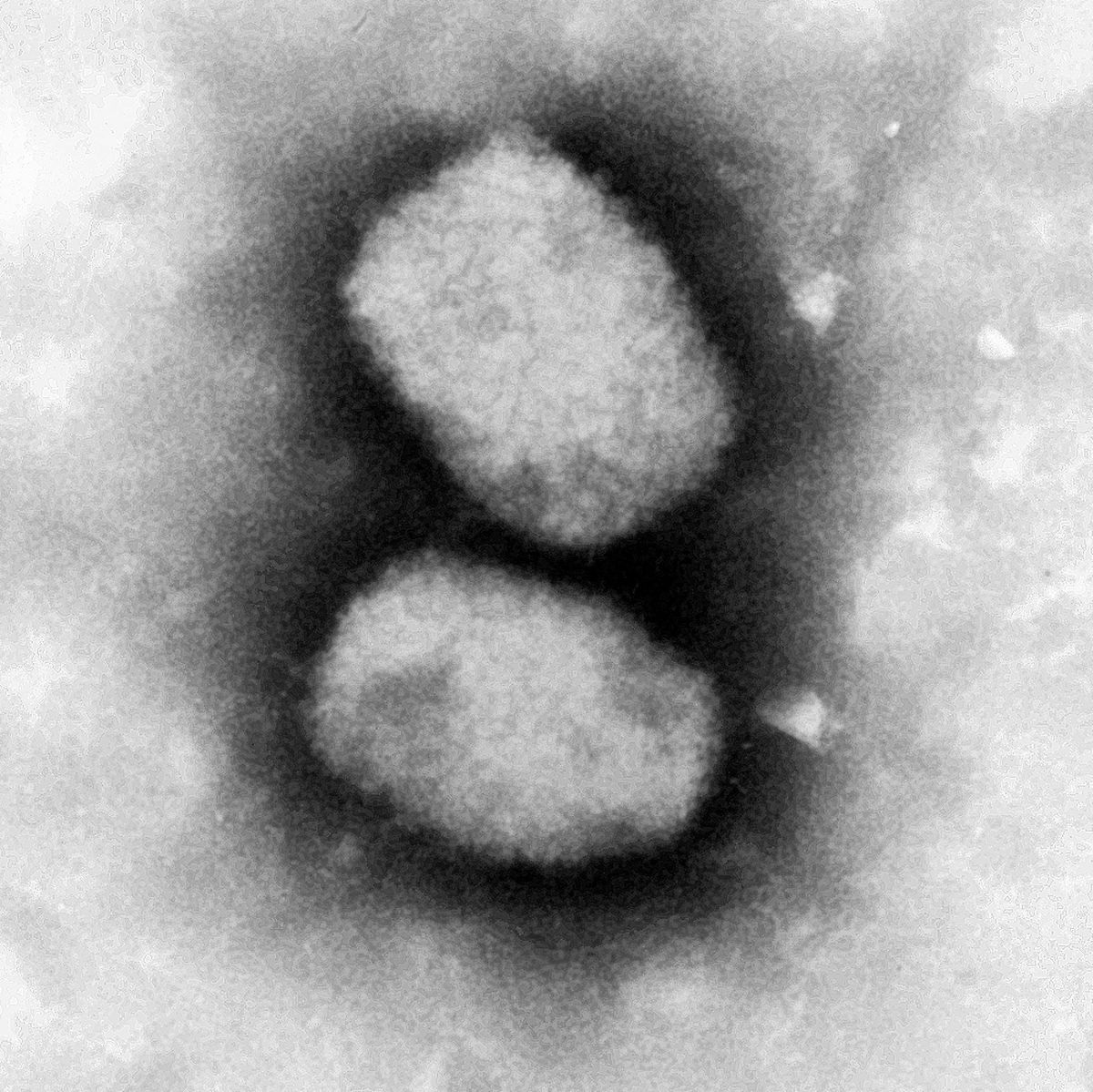 Diese vom Robert Koch-Institut (RKI) zur Verfügung gestellte elektronenmikroskopische Aufnahme zeigt das Affenpockenvirus. 