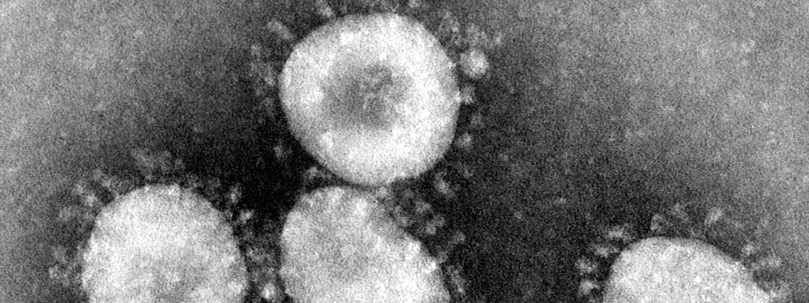 Dieses Handout des amerikanischen Centers for Disease Control (CDC) zeigt einen Coronavirus unter dem Mikroskop.