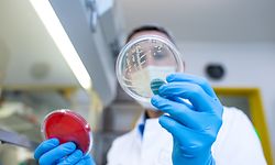 PRODUKTION - 22.04.2021, Nordrhein-Westfalen, Münster: Prof. Alexander Mellmann, EHEC-Experte, Facharzt für Mikrobiologe und Hygiene am Universitätsklinikum Münster untersucht Proben verschiedener Keime, die auf Petrischalen kultiviert werden. Mellmann leitet das Nationale Konsiliarlabor für das HUS-Syndrom, der schwersten Erkrankungsform des Darmskeims, und pflegt eine der weltweit größten Sammlungen an EHEC-Erregerstämmen. Am 1. Mai 2011 war der erste Patient an blutigem Durchfall erkrankt. Die Suche nach der Herkunft des Keims dauerte Monate. Am Ende galten Bockshornkleesamen aus Ägypten für die Anzucht von Sprossen als Auslöser. Forscher aus Münster entschlüsselten das Erbgut des Erregers. Welche Schlüsse haben die Behörden seitdem gezogen? Gibt es Langzeitfolgen für die Betroffenen? (zu dpa «Schlimmster Ehec-Ausbruch: Was den Darmkeim 2011 so tückisch machte») Foto: Guido Kirchner/dpa +++ dpa-Bildfunk +++