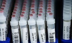 ARCHIV - 01.02.2021, Rheinland-Pfalz, Ingelheim: Kunststoffröhrchen mit Corona-Abstrichen stehen nach dem PCR-Test im Großlabor von Bioscientia. (zu dpa «Ein Risiko für Lockerungen: «Große Sorgen» wegen Corona-Varianten») Foto: Andreas Arnold/dpa +++ dpa-Bildfunk +++