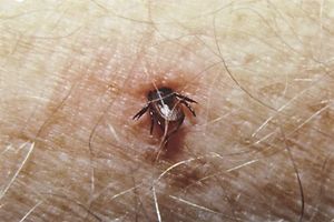 Bisher konnte noch kein Impfstoff gegen die Lyme-Borreliose entwickelt werden.