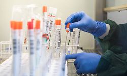 27.03.2020, Schleswig-Holstein, Geesthacht: Eine Mitarbeiterin des Zentrallabors des LADR-Laborverbundes Dr. Kramer und Kollegen überführt einen trockenen Abstrich eines molekularbiologischen Tests auf das SARS-CoV-2-Virus in eine Flüssigkeit. In dem Labor werden derzeit rund 1500 Corona-Tests pro Tag ausgewertet. (zu dpa "Labor in Geesthacht testet 1500 Proben am Tag") Foto: Daniel Bockwoldt/dpa +++ dpa-Bildfunk +++