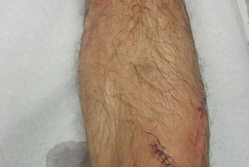 Coupe de Luxembourg des Seniors Réserves : Boevange-Beckerich: du verre sur la pelouse