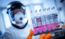 dpatopbilder - 01.04.2020, Niedersachsen, Hannover: Eine wissenschaftliche Mitarbeiterin hält Coronavirus-Testproben im Niedersächsischen Landesamt für Verbraucherschutz und Lebensmittelsicherheit (LAVES) in der Hand. Niedersachsen stockt mit der Nutzung von tiermedizinischen Laboren seine Kapazitäten für Tests auf das Coronavirus deutlich auf. Foto: Peter Steffen/dpa +++ dpa-Bildfunk +++