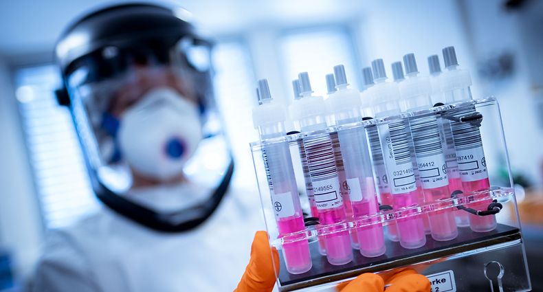 dpatopbilder - 01.04.2020, Niedersachsen, Hannover: Eine wissenschaftliche Mitarbeiterin hält Coronavirus-Testproben im Niedersächsischen Landesamt für Verbraucherschutz und Lebensmittelsicherheit (LAVES) in der Hand. Niedersachsen stockt mit der Nutzung von tiermedizinischen Laboren seine Kapazitäten für Tests auf das Coronavirus deutlich auf. Foto: Peter Steffen/dpa +++ dpa-Bildfunk +++