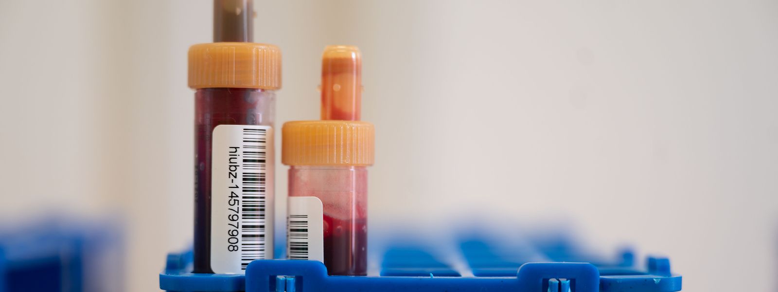 Blutproben von Covid-19-Patienten in einem Testzentrum.