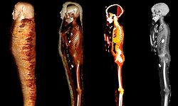 HANDOUT - 20.01.2023, Ägypten, Kairo: Das digitale Abbild zeigt das Innere der Mumie «Goldjunge» in vier Schichten. Mit Hilfe eines CT-Scanners haben Wissenschaftler eine 2300 Jahre alte und noch nie geöffnete Mumie durchleuchtet. (zu dpa «2300 Jahre alte Mumie durchleuchtet - Edles für Reise ins Jenseits») Foto: SN Saleem/SA Seddik/M el-Halwagy/dpa - ACHTUNG: Nur zur redaktionellen Verwendung im Zusammenhang mit der aktuellen Berichterstattung und nur mit vollständiger Nennung des vorstehenden Credits +++ dpa-Bildfunk +++