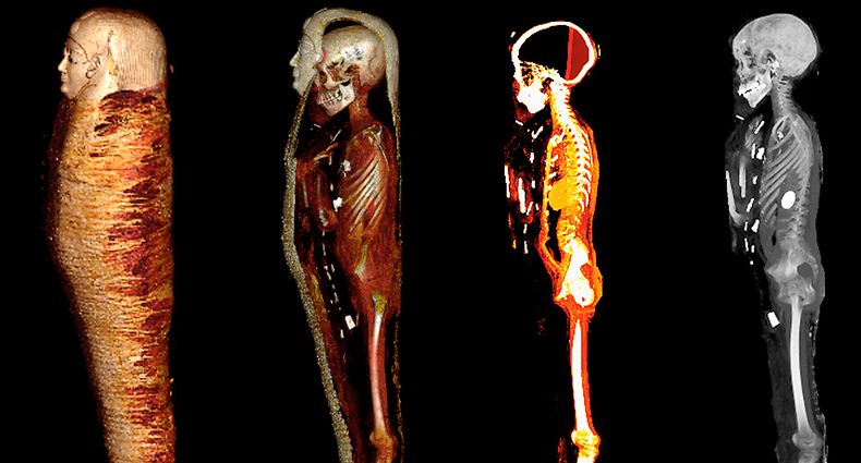 HANDOUT - 20.01.2023, Ägypten, Kairo: Das digitale Abbild zeigt das Innere der Mumie «Goldjunge» in vier Schichten. Mit Hilfe eines CT-Scanners haben Wissenschaftler eine 2300 Jahre alte und noch nie geöffnete Mumie durchleuchtet. (zu dpa «2300 Jahre alte Mumie durchleuchtet - Edles für Reise ins Jenseits») Foto: SN Saleem/SA Seddik/M el-Halwagy/dpa - ACHTUNG: Nur zur redaktionellen Verwendung im Zusammenhang mit der aktuellen Berichterstattung und nur mit vollständiger Nennung des vorstehenden Credits +++ dpa-Bildfunk +++