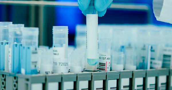 Deutschland erwägt, PCR-Tests auf anfällige und asymptomatische Gruppen zu beschränken