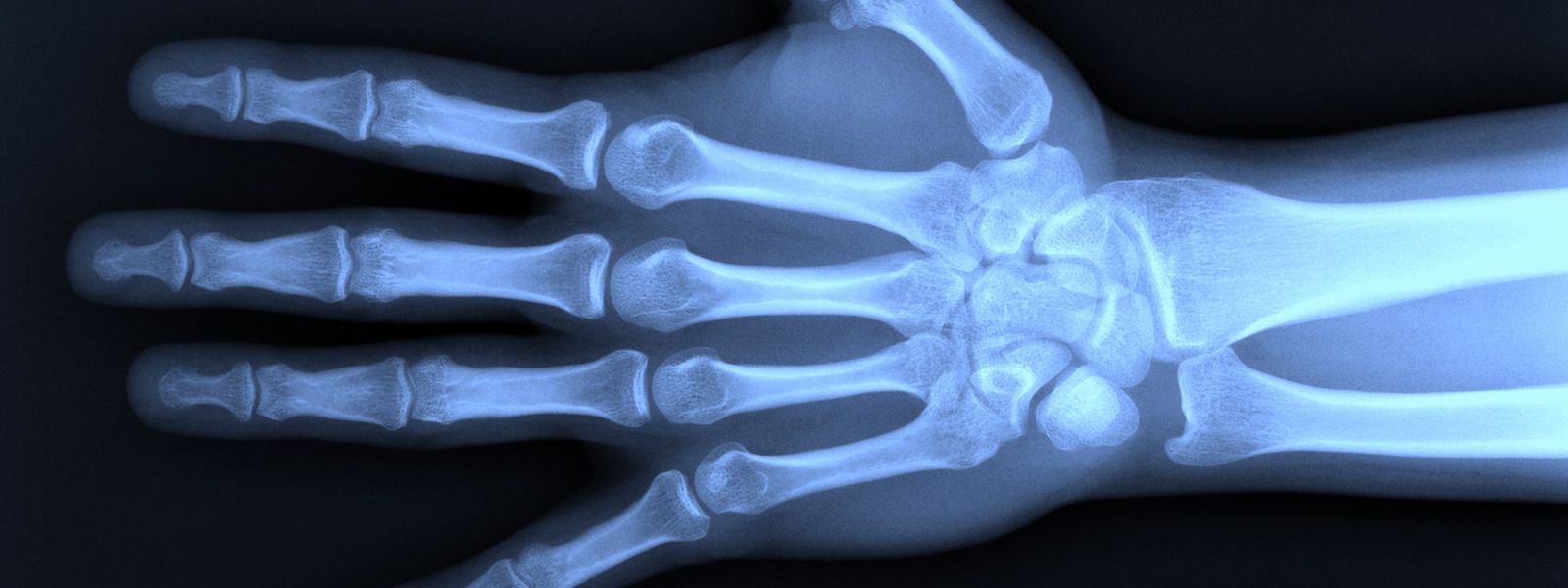 In den Anfangsjahren sorgten vor allem Röntgenaufnahmen der Hände für großes Staunen.