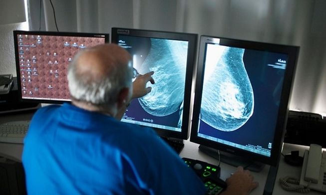 Every woman between the age of 50 and 69 can get a free mammography every two years