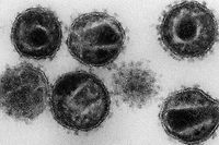 Micrografia electrónica de vários agentes patogénicos do VIH num paciente.