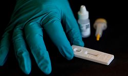 A picture taken on April 20, 2020, in Lieges, shows a technician carrying out a COVID-19 (novel coronavirus) serological test with a kit produced by Belgian biotechnical company ZenTech. (Photo by kenzo tribouillard / AFP)