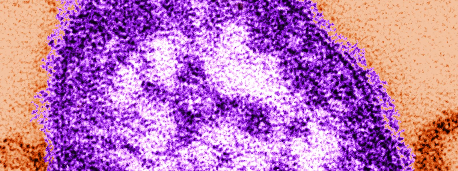 Ein Masernvirus unter dem Elektronenmikroskop.