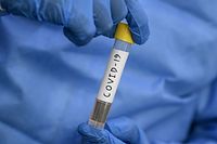 A laboratory technician from Dr. Dangs Lab displays a coronavirus testing tube for a drive-through service during a government-imposed nationwide lockdown as a preventive measure against the COVID-19 coronavirus, in New Delhi on April 7, 2020. (Photo by Sajjad  HUSSAIN / AFP)