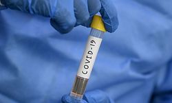 A laboratory technician from Dr. Dangs Lab displays a coronavirus testing tube for a drive-through service during a government-imposed nationwide lockdown as a preventive measure against the COVID-19 coronavirus, in New Delhi on April 7, 2020. (Photo by Sajjad  HUSSAIN / AFP)