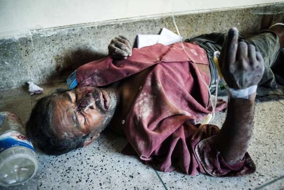 TOPSHOTS A Bangladeshi survivor of the collapse of a partly-built cement factory in southern Mongla town, lies on the floor of a hospital in Khulna on March 12, 2015. The roof of a partly-built cement factory collapsed in southern Bangladesh, killing at least four workers and dozens others feared trapped under the debris, police and rescuers said. AFP PHOTO / SHAIKH MOHIR UDDIN