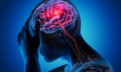 Schlaganfall, Gehirnschlag, Hirnschlag, Apoplexie