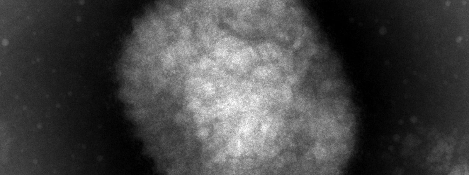 La variole du singe vue au microscope électronique.