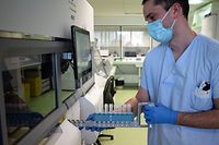 A laboratory technician handles swab samples in the microbiology department, where a high demand in PCR tests has led to intense activity, at the Emile-Muller hospital in Mulhouse, eastern France, on November 17, 2020, amid the Covid-19 (novel coronavirus) pandemic. - The Emile-Muller Hospital had 100 Covid-19 patients on November 17, 18 of whom were in intensive care. A clear increase was felt since the beginning of November, but far from the "wall" encountered during the spring, when a military hospital was built on the parking lot to reach up to 500 Covid beds. (Photo by PATRICK HERTZOG / AFP)