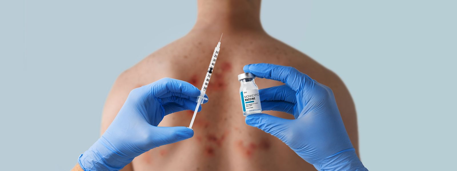 Les personnes à risque peuvent se faire vacciner contre la variole du singe depuis le 16 août. 
